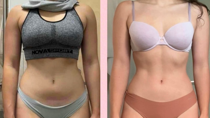 Transformation Image 2